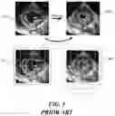 Fig. 05 - Motion learning without labels