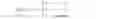 Fig. 02 - Sample distance calculation for geometric partition mode