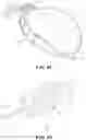 Fig. 09 - Sterilization systems and methods of use thereof