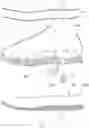 Fig. 04 - Shock absorption shoe having at least one inflatable shock absorption module hidden inside the shoe in which air pressure is adjustable