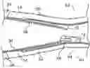 Fig. 01 - Method of sealing a zipper closure and a sealed zipper assembly