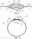 Fig. 06 - Method of sealing a zipper closure and a sealed zipper assembly