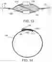 Fig. 08 - Method of sealing a zipper closure and a sealed zipper assembly