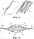 Fig. 09 - Method of sealing a zipper closure and a sealed zipper assembly