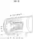 Fig. 13 - Hair dryer