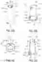 Fig. 06 - Oral care system including an oral care implement and a tracking attachment, tracking attachment thereof, and method of assembling the same