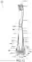 Fig. 15 - Oral care system including an oral care implement and a tracking attachment, tracking attachment thereof, and method of assembling the same