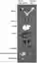 Fig. 01 - TARGETED FLUORESCENT MARKERS IN COMBINATION WITH A FLEXIBLE PROBE