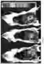 Fig. 06 - TARGETED FLUORESCENT MARKERS IN COMBINATION WITH A FLEXIBLE PROBE