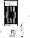 Fig. 02 - Dental Image Feature Detection