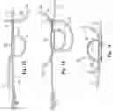 Fig. 07 - Soft Suture Anchor