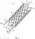 Fig. 02 - SYSTEMS AND METHODS FOR TREATMENT OF DEFECTS IN THE VASCULATURE