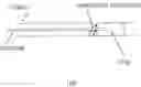 Fig. 01 - METHODS FOR PREVENTING RETROPULSION OF CONCRETIONS AND FRAGMENTS DURING LITHOTRIPSY