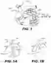 Fig. 02 - ENDOVASCULAR DEVICES AND METHODS FOR EXPLOITING INTRAMURAL SPACE