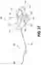Fig. 71 - ENDOVASCULAR DEVICES AND METHODS FOR EXPLOITING INTRAMURAL SPACE
