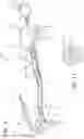 Fig. 02 - Bone cement delivery systems including a flow diverter and drool accumulator