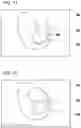 Fig. 09 - CRANIOTOMY SIMULATION DEVICE, METHOD, AND PROGRAM