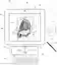 Fig. 01 - SURGICAL PLANNING, SURGICAL NAVIGATION AND IMAGING SYSTEM