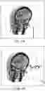 Fig. 06 - SURGICAL PLANNING, SURGICAL NAVIGATION AND IMAGING SYSTEM