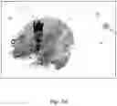 Fig. 07 - SURGICAL PLANNING, SURGICAL NAVIGATION AND IMAGING SYSTEM