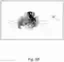 Fig. 08 - SURGICAL PLANNING, SURGICAL NAVIGATION AND IMAGING SYSTEM