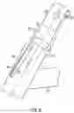 Fig. 09 - Robot Assisted Volume Removal During Surgery