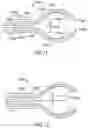 Fig. 08 - Side-looking minimally invasive surgery instrument assembly