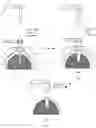 Fig. 02 - HANDPIECE, SYSTEM AND METHOD FOR DENTAL IMPLANT GUIDED SURGERY