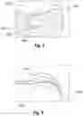 Fig. 02 - Dental stent
