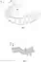 Fig. 02 - Parylene dental articles