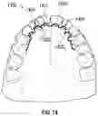 Fig. 16 - DENTAL APPLIANCES AND ASSOCIATED SYSTEMS AND METHODS OF USE