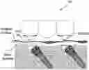 Fig. 01 - Dental implant device and system