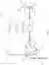 Fig. 02 - SYSTEM AND METHOD OF USE FOR CAROTID STENTING
