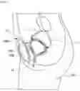 Fig. 02 - Biomimetic artificial bladder and method for controlling same