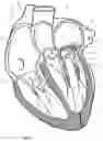 Fig. 02 - IMPLANT FOR IMPROVING COAPTATION OF AN ATRIOVENTRICULAR VALVE