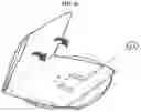 Fig. 17 - ONE PIECE OSTOMY POUCH ENHANCEMENTS