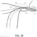 Fig. 06 - Systems and methods for permanent female contraception