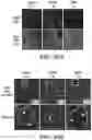 Fig. 43 - METHODS AND COMPOSITIONS FOR TREATING LAMINOPATHIES AFFECTING SKELETAL OR CARDIAC MUSCLE