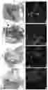 Fig. 02 - CD11B + PIEZO-1 + MACROPHAGES AND USES THEREOF