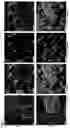 Fig. 07 - CD11B + PIEZO-1 + MACROPHAGES AND USES THEREOF