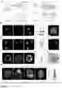 Fig. 02 - PD-L1 PRESENTING PLATELETS REVERSE NEW-ONSET TYPE 1 DIABETES