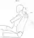 Fig. 02 - Vehicle airbag system