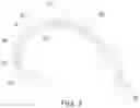 Fig. 04 - Multi-layer bladder construct