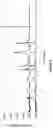 Fig. 07 - Crystalline forms of therapeutic compounds and uses thereof