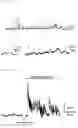 Fig. 09 - ELECTRODE HAVING NANO STRUCTURE AT TIP