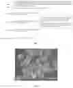 Fig. 02 - Method for preparing 3D brain organoids