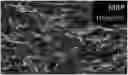 Fig. 01 - DIFFERENTIATION MEDIUM AND METHOD FOR PREPARING OLIGODENDROCYTE PRECURSOR