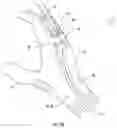 Fig. 03 - Wearable device capable of inducing electro-muscular incapacitation
