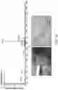 Fig. 02 - Mass spectral tissue analysis