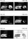 Fig. 07 - Mass spectral tissue analysis